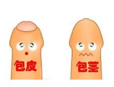 湛江包莖的男性為何一定要做手術